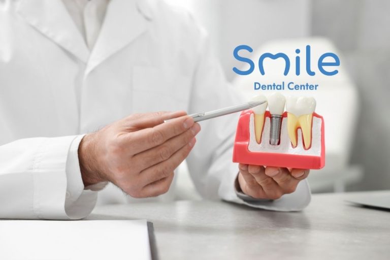 8 signs that you need dental implants in turkey